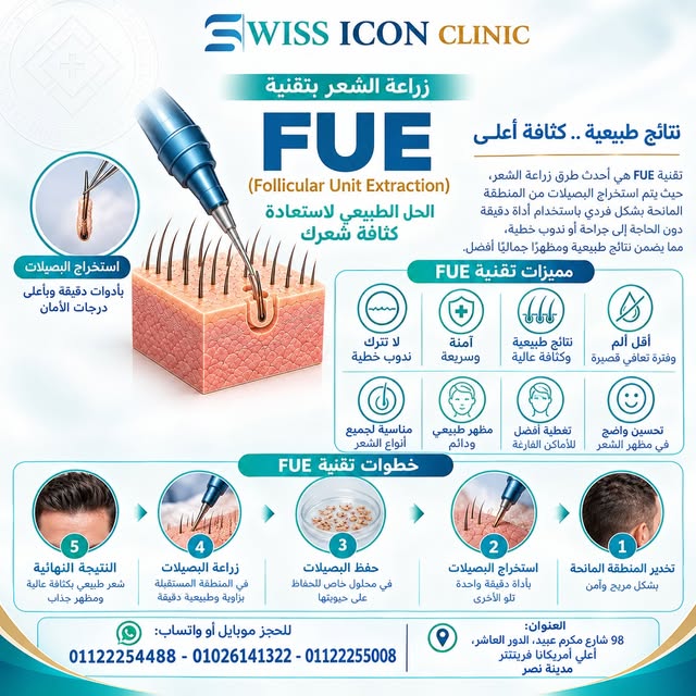 قبل متزرع شعرك لازم تعرف اي هي تقنية الم FUE 👌
للحجز موبايل أو واتساب: 01122254488 - 01026141322 - 