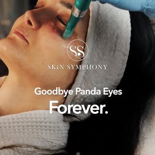 Cosmetologist @drhalimasaeid offers advanced under-eye treatments designed to correct genetic dark c