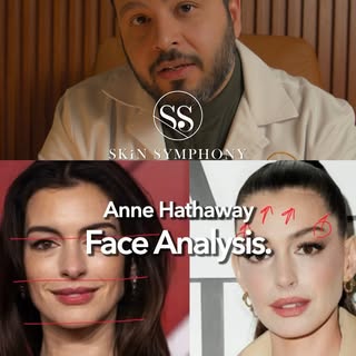 Comment below which celebrity would you like @drarzhangjavadi to analyze next.

Actress: Anne Hathaw