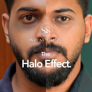 “Only two sessions in… and the difference already feels unreal. 

My under-eye darkness looks visibl