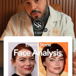 Based on multiple requests from our patients, Here’s Emma Stone! 
Celebrity face analysis by @drarzh