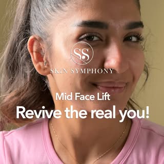 Revive the real you — not by changing your face, but by restoring the softness, lift, and confidence