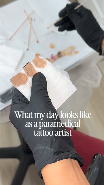 Tummy Tuck Surgery Scars
Breast Augmentation Surgery Scars (Areolas)
Mastectomy Scars
Breast Reducti
