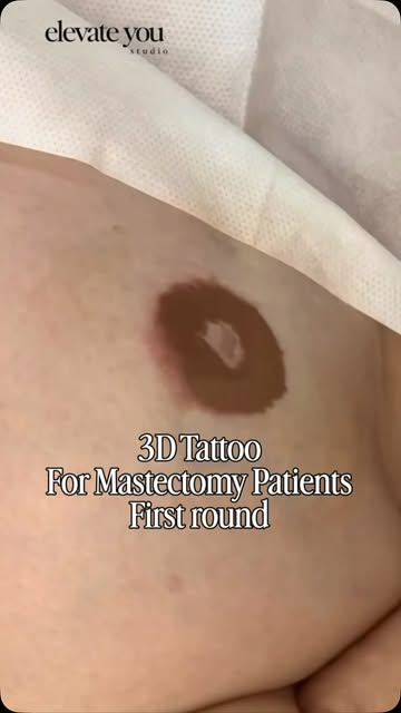 3D Tattoo for Mastectomy Patients 
Elevate You Studio
Gina Lee
South Pasadena CA