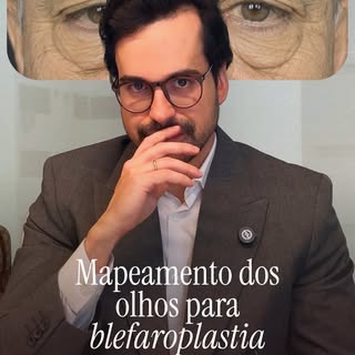 Blefaroplastia não é igual para todo mundo.

Antes de pensar no resultado, é preciso entender o que 