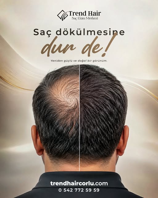 Her kök, olması gereken yönde; sonuç ise fark edilmez kadar doğal.

Yeni bir görünüm değil, yeni bir