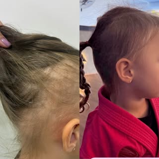 ✨ 3 meses de tratamento. E que evolução! ✨

Essa pequena iniciou o acompanhamento aos 2 anos e meio,