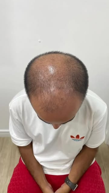 Uma mudança radical !!!!!