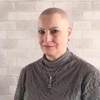 🙌🏻Isso sim é TRANSFORMAÇÃO🙌🏻
Micropigmentação Capilar em Alopécia universal feminina 

#alopecia