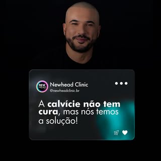 Meus queridões e minhas queridonas, cientificamente não é possível reverter a calvície, entretanto, 