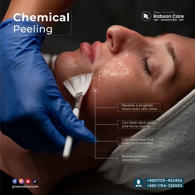 Chemical Peeling✨

✅ Reveals a brighter, more even skin tone
✅ Can fade dark spots and Acne marks
✅ 