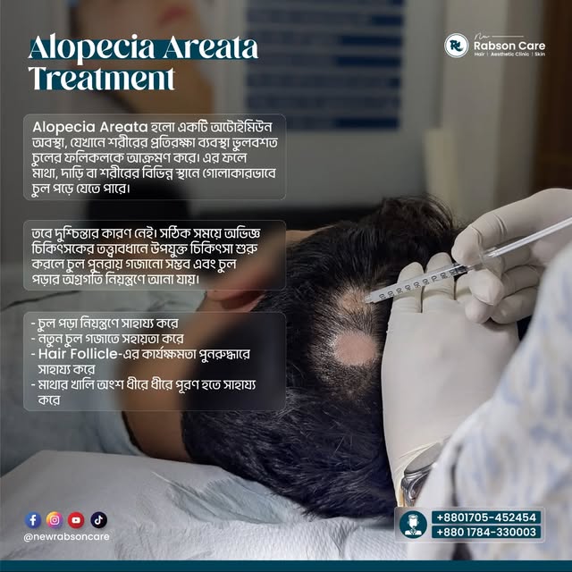 ✨ হঠাৎ গোলাকারভাবে চুল পড়ে যাচ্ছে? হতে পারে Alopecia Areata

Alopecia Areata হলো একটি অটোইমিউন অবস্থ