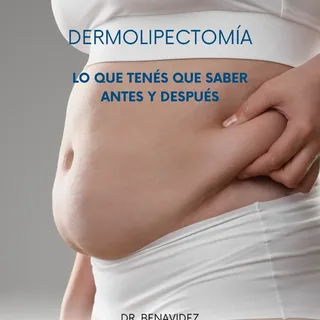 🔸La Dermolipectomia es la cirugía de abdomen que tiene como fin eliminar la piel y la grasa sobrant