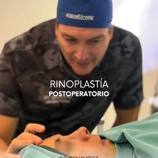 🔸El postoperatorio de una rinoplastia suele sorprender a la mayoría de los pacientes porque no es u