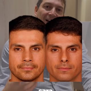 RINOPLASTIA ℹ️
Animate al cambio hoy! 
👉🏻 Una nariz personalizada ideal para tu cara, que mejore t