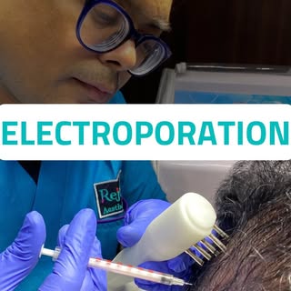 Post Hair Transplant Needle Free Growth Factor Treatment For Existing Hair Fall Control | By Dr Sant