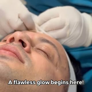 Crystal Dermabrasion is a gentle, non-invasive skin resurfacing treatment designed to reveal smoothe