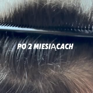 Kiedy mówisz klientowi: proszę uzbroić się w cierpliwość… a po 2 miesiącach widzimy to 😍❤️

 #łysie