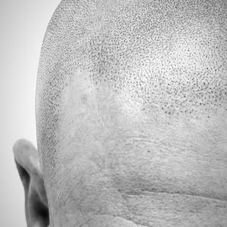 La clave de una buena micropigmentación capilar está en la línea frontal.

Una línea demasiado perfe