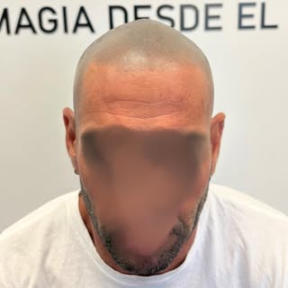 No esperes otro año para verte como quieres verte.

Miles de personas conviven con la pérdida capila