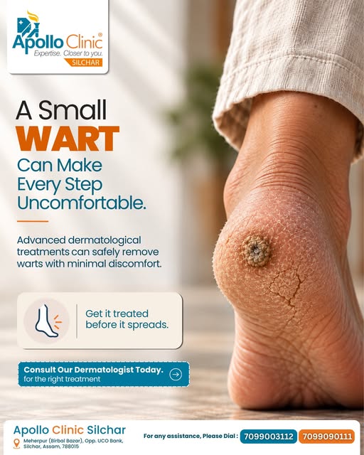 A small wart can make every single step uncomfortable! 🦶⚡ 
Plantar warts and skin lesions aren't ju