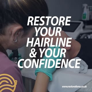 There’s still time to have your hair line restored for the new year 💥🎉🥳

Take advantage of our li
