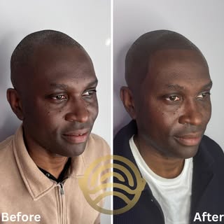Looking 10 years younger 😎

Swipe for 5 star review ➡️🤩⭐️

Book your free consultation today to fi