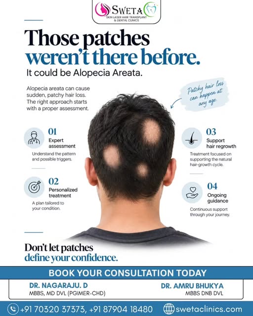 Sudden patches in your hair? Don’t ignore them. 👀

Patchy hair loss can be a sign of Alopecia Areat