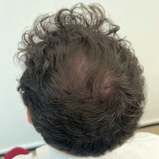 •Infoltimento Uomo•
Scorri per vedere il prima 🖤
Contattami per la tua consulenza gratuita. 
Anche 