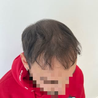 •Infoltimento Uomo•
Scorri per vedere il prima 🖤
Contattami per la tua consulenza gratuita. 
Anche 