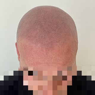 • Effetto Rasato •
Scorri per vedere il prima e dopo ➡️

Contattami per la tua consulenza gratuita, 