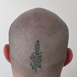 TRICO & TATTOO🖤
❌Correzione Tricopigmentazione eseguita da un altro operatore❌
•
Contattami per la 