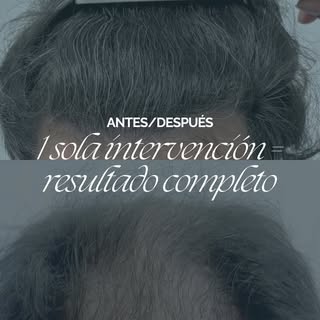 Volver a verse bien también forma parte del proceso 🤗

Así evoluciona nuestro paciente tras un inje