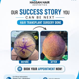 ✨ SUCCESS STORIES START WITH ONE STEP! ✨

Ready to restore your confidence and achieve a fuller, nat