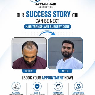 ✨ Success Story Today, Confidence Forever!

Transform your look with advanced Hair Transplant Surger