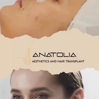 ✨ Your Complete Glow-Up Programme ✨

At Anatolia Aesthetics, we're here to help you look and feel yo