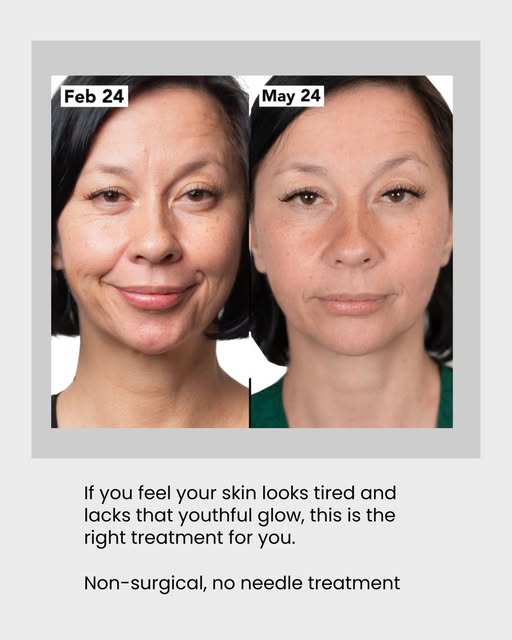 The best compliments I get aren’t about skin, they’re about confidence. “I feel like myself again” m