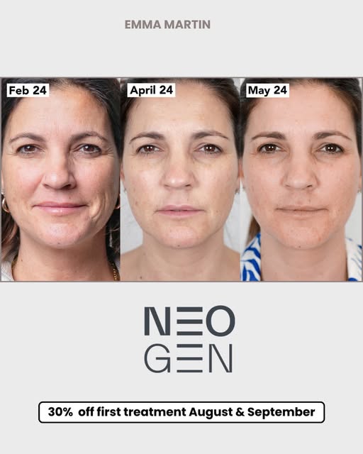 Fine lines, sun damage, scarring, uneven tone, NeoGen genuinely covers a lot of ground in one treatm