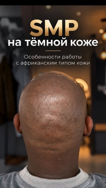 SMP на тёмной коже — это не просто «взять более тёмный пигмент».

Здесь особенно важно понимать, как