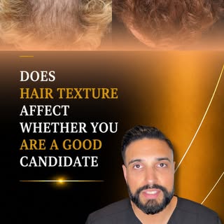 When planning a hair transplant, we consider characteristics such as:

• Straight, wavy, or curly ha