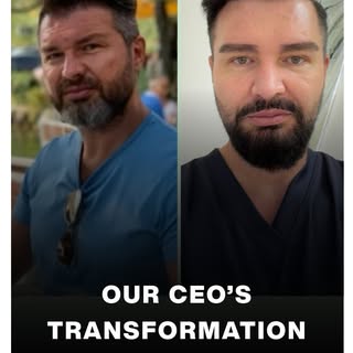 What if you could turn back the clock? 😲

Watch Mr. Sam’s incredible 10-year transformation. At 46 