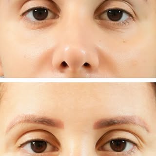 Small details. Big difference. ✨

A carefully designed Long Eyebrow Transplant for fuller, more defi