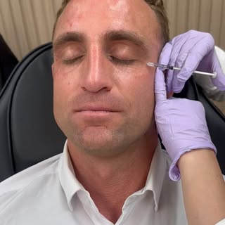 Men need pampering too 🧖🏻💉 

#sandiegobotox #sandiegomedspa #menbotox #menselfcare #nursepraction