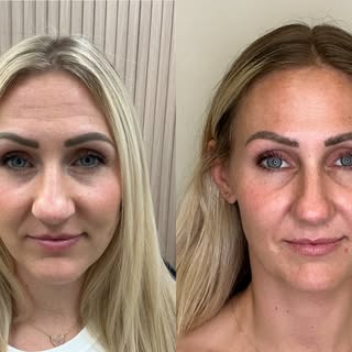 When your before starts looking like an after…

Both of these photos were taken before treatment — j