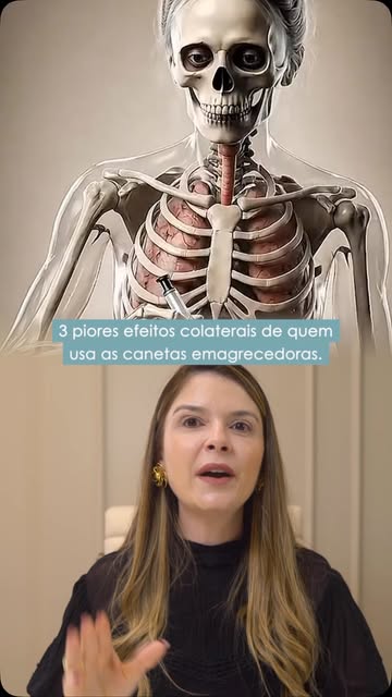Três piores efeitos colaterais de quem usa as canetas emagrecedoras. 
#emagrecimentos #envelheciment