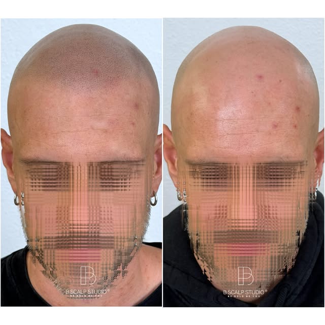 ✨ Natural, discreto e que se encaixa no cliente como se fosse dele desde sempre…
Não trabalhamos só 