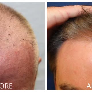 California Hair, MD is the first and only practice in Orange County and San Diego counties offering 