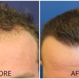 California Hair, MD is the first and only practice in Orange County and San Diego counties offering 