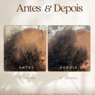 Sofrendo com queda de cabelo, fios finos e não sabe mais o que fazer? 

Arraste pro lado e acompanhe