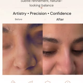 Redefining your natural contours, one subtle touch at a time. ✨ It’s not about changing how you look